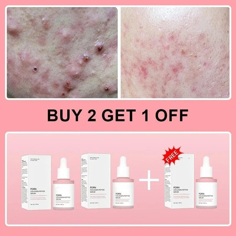 Sérum facial aux peptides de collagène et PDRN de saumon – Soin régénérant et élasticité de la peau