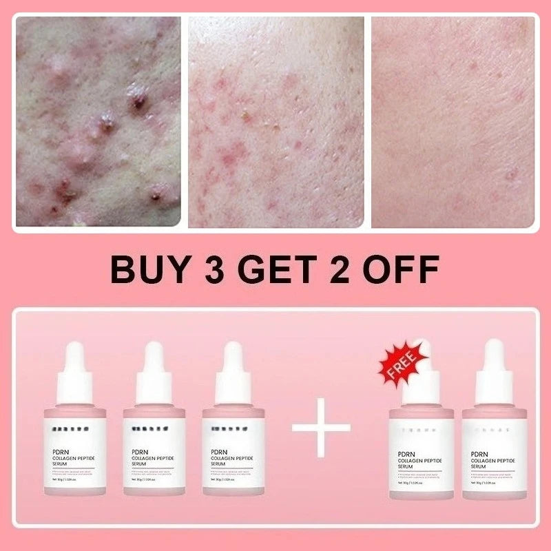Sérum facial aux peptides de collagène et PDRN de saumon – Soin régénérant et élasticité de la peau